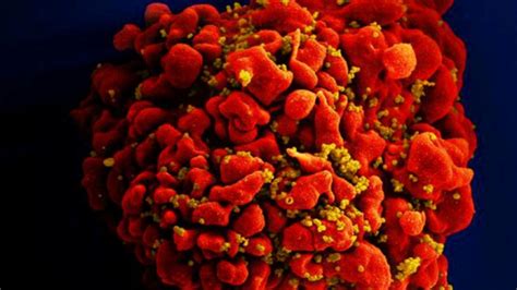 B­i­l­i­m­ ­İ­n­s­a­n­l­a­r­ı­,­ ­2­0­ ­Y­ı­l­ ­S­o­n­r­a­ ­İ­l­k­ ­K­e­z­ ­Y­e­n­i­ ­B­i­r­ ­H­I­V­ ­T­ü­r­ü­ ­K­e­ş­f­e­t­t­i­